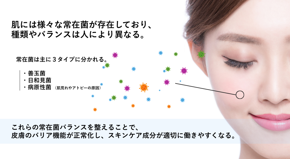 善玉菌、日和見菌、病原性菌、アトピー